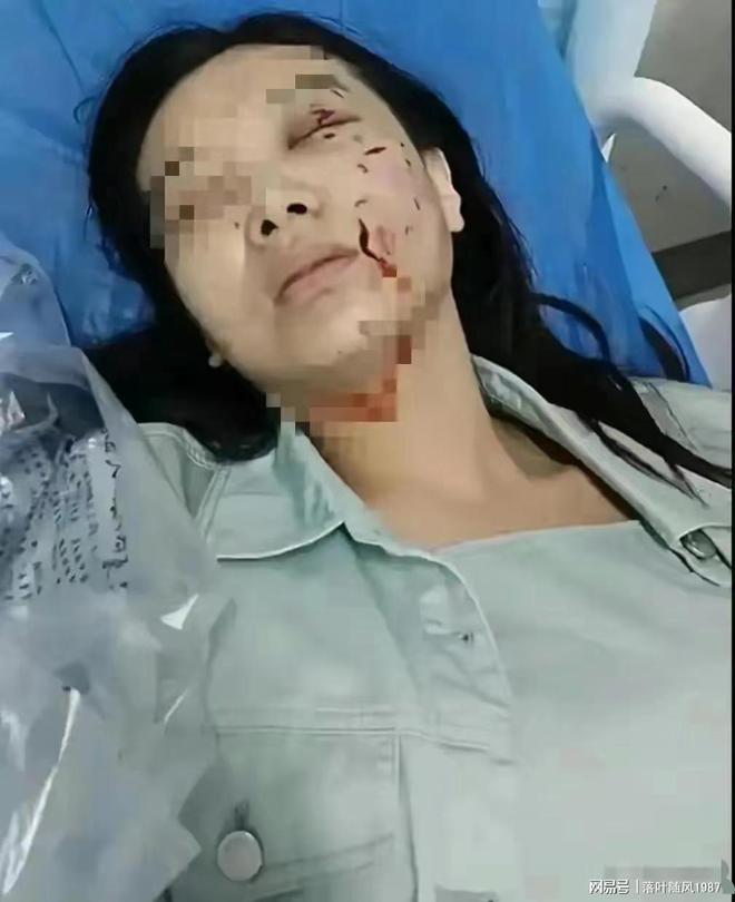 下载.jpg